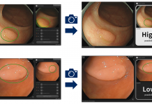 NEC – 大腸内視鏡画像から腫瘍性病変を識別するAIシステム