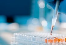 血清ラマン分光法とAI – アルツハイマー病の新しいスクリーニング手法開発に向けて