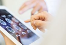 エルピクセル – CT画像から頭蓋内の高輝度領域を抽出するAIソフトウェア