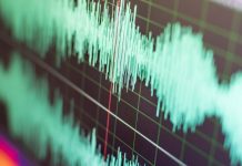 AIミリ波レーダーで皮膚に触れずに動脈硬化を多部位同時計測