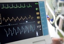 AIミリ波レーダーで皮膚に触れずに動脈硬化を多部位同時計測