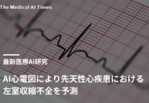 AI心電図により先天性心疾患における左室収縮不全を予測