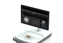 Perimeter – 術中に病変微細構造を確認できるOCTシステムでFDA認証を取得