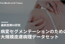 病変セグメンテーションのための大規模皮膚病理データセット