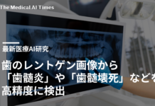 歯のレントゲン画像から「歯髄炎」や「歯髄壊死」などを高精度に検出