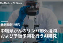 中咽頭がんのリンパ節外浸潤および予後予測を行うAI研究