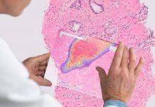 Ibexの新たな資金調達 – 病理学AIの雄へ