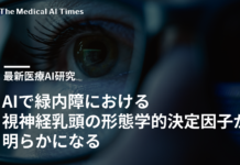 AIで緑内障における視神経乳頭の形態学的決定因子が明らかになる