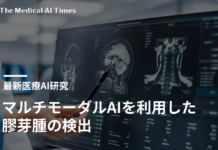 マルチモーダルAIを利用した膠芽腫の検出