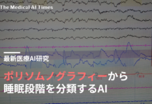ポリソムノグラフィーから睡眠段階を分類するAI