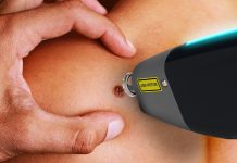 韓国Speclipse社 – レーザー分光とAIによる皮膚がん診断デバイス