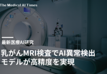 乳がんMRI検査でAI異常検出モデルが高精度を実現