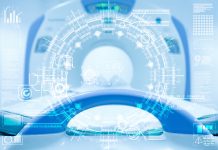 AIが肺がん診断を1年早める可能性