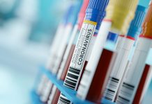 標準血液検査項目から驚異的精度でCOVID-19を識別