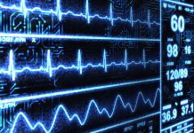 AI心電図 – リスク患者の特定により院内死亡を大幅に低減