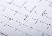 心電図を活用して肺塞栓症を検出するAI研究