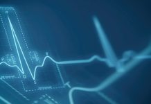 心電図から「心房細動と心原性脳梗塞の発症」を予測